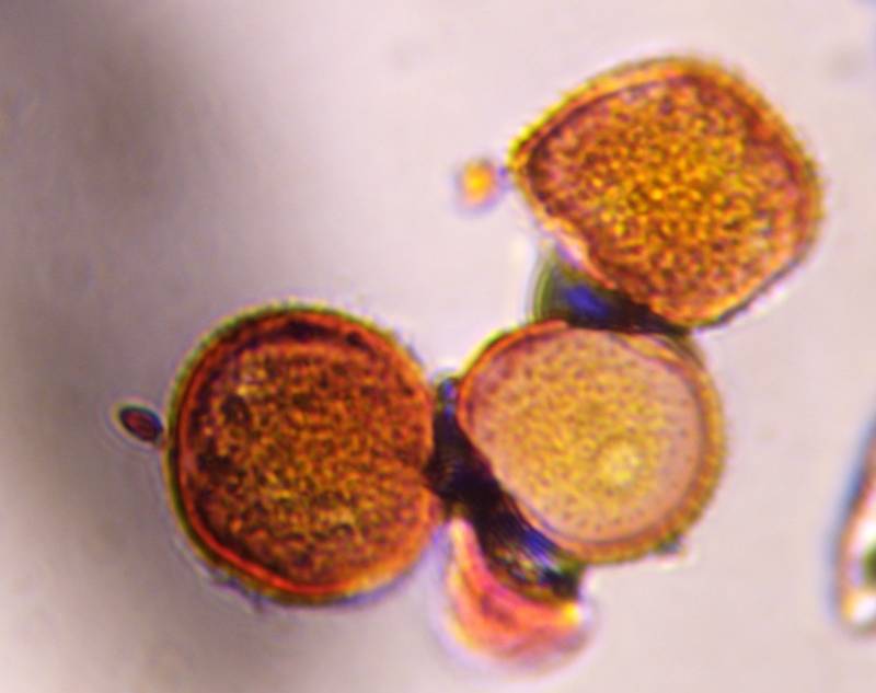 Microscope image of Unknown — pollen (gallery) — verified by PollyMap