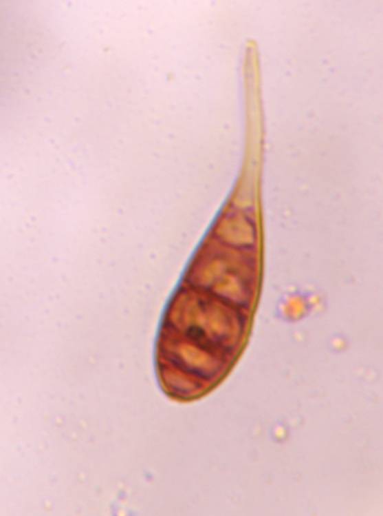 Microscope image of Alternaria — mold (gallery) — verified by PollyMap