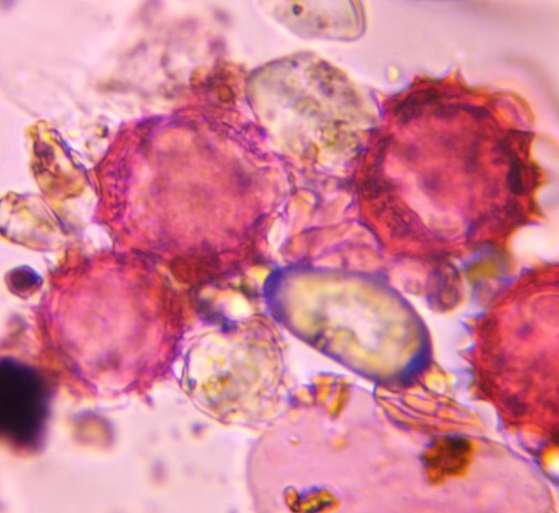 Microscope image of Asteraceae — pollen (gallery) — verified by PollyMap