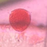 Microscope image of Grass — pollen (gallery) — verified by PollyMap