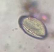 Microscope image of Palm — pollen (reference) — verified by PollyMap