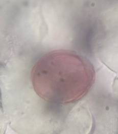 Microscope image of unidentified — pollen (gallery) — verified by PollyMap