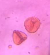 Microscope image of Eucalyptus — pollen (reference) — verified by PollyMap