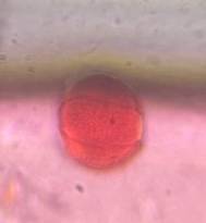 Microscope image of Oak — pollen (gallery) — verified by PollyMap