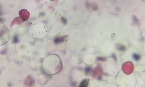 Microscope image of Oak — pollen (gallery) — verified by PollyMap