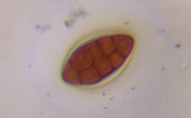 Microscope image of Ulocladium — mold (gallery) — verified by PollyMap