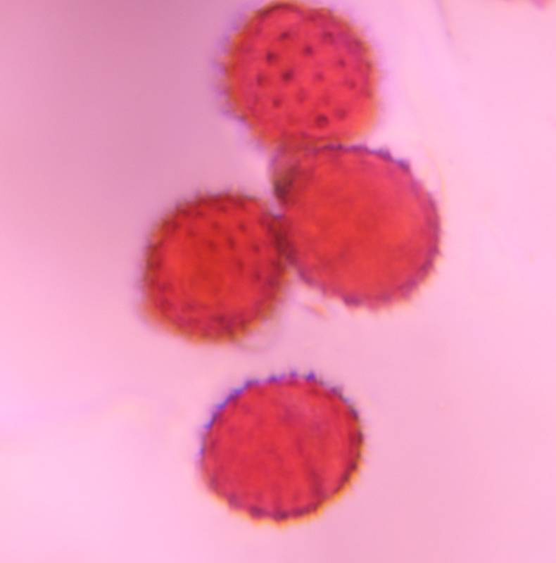 Microscope image of Asteraceae — pollen (gallery) — verified by PollyMap