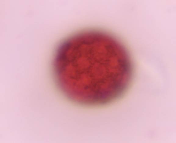 Microscope image of Chenopod — pollen (gallery) — verified by PollyMap