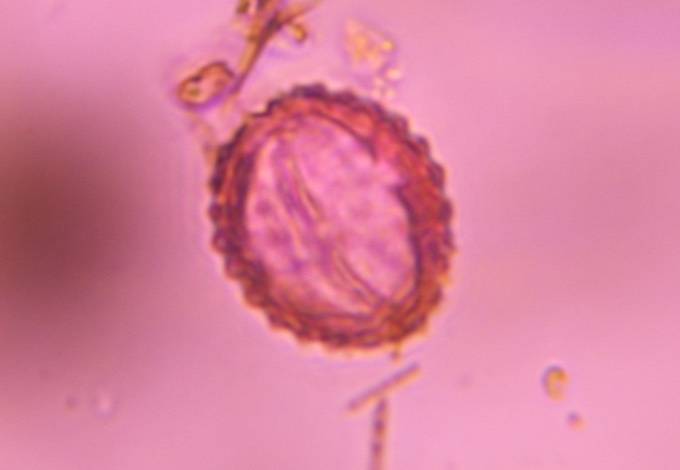 Microscope image of Asteraceae — pollen (gallery) — verified by PollyMap