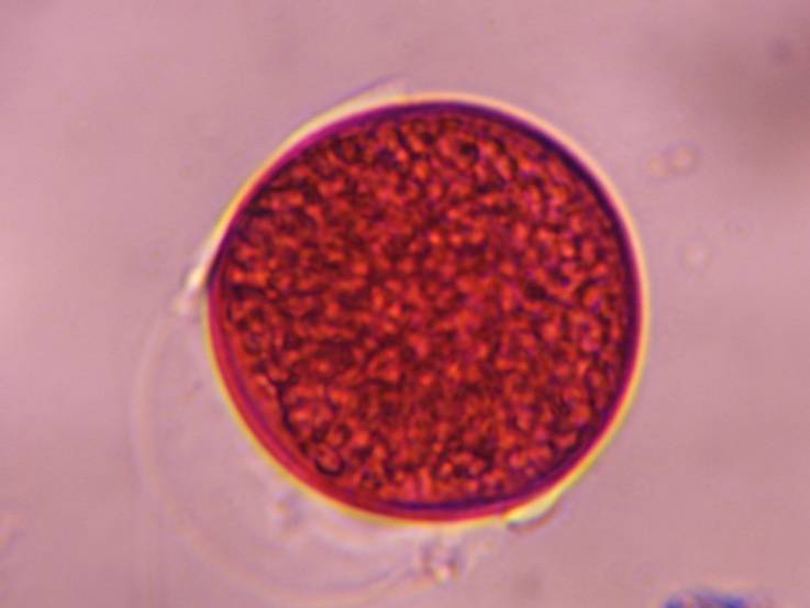 Microscope image of Poaceae — pollen (gallery) — verified by PollyMap