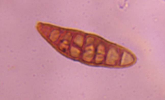 Microscope image of Alternaria — mold (gallery) — verified by PollyMap
