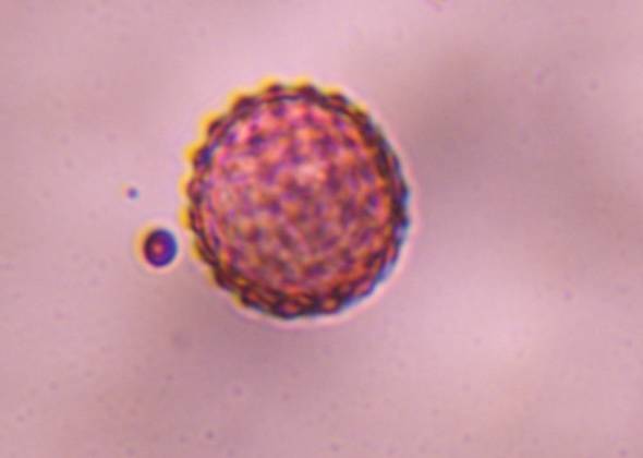 Microscope image of Chenopod — pollen (gallery) — verified by PollyMap
