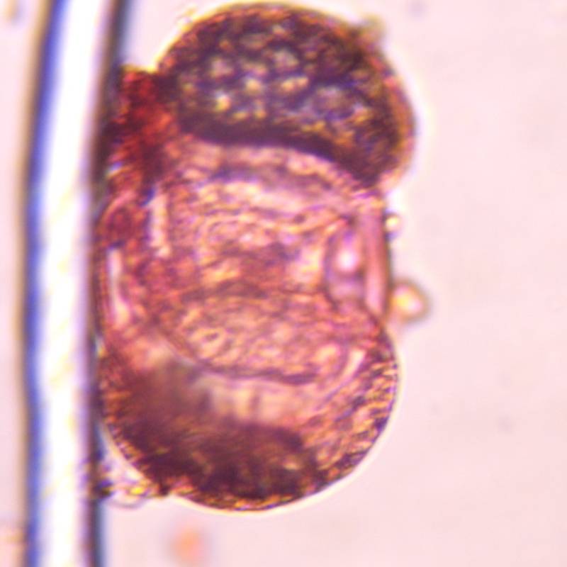 Microscope image of Pine — pollen (gallery) — verified by PollyMap