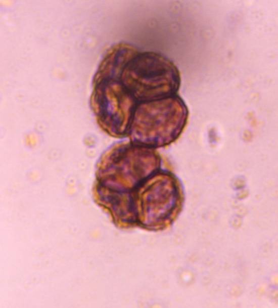 Microscope image of Unknown dematiaceous mold — mold (reference) — verified by PollyMap