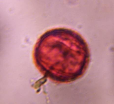 Microscope image of Unknown — pollen (gallery) — verified by PollyMap