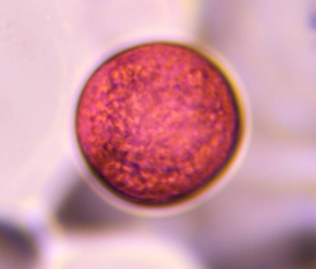 Microscope image of Poaceae — pollen (gallery) — verified by PollyMap
