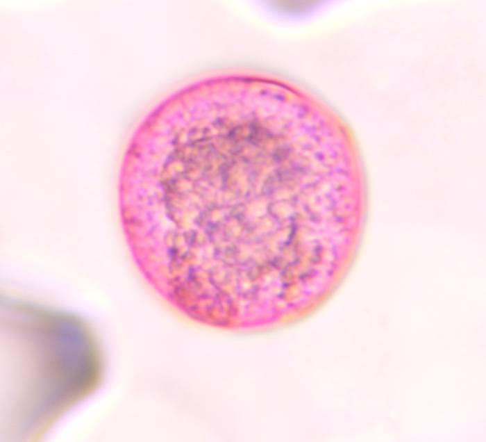 Microscope image of Poaceae — pollen (gallery) — verified by PollyMap