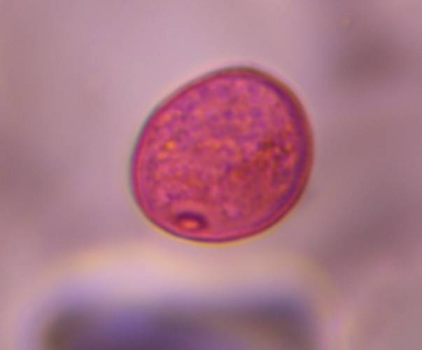 Microscope image of Poaceae — pollen (gallery) — verified by PollyMap