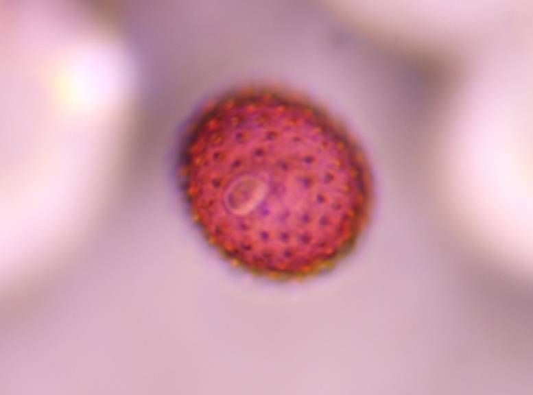 Microscope image of Asteraceae — pollen (gallery) — verified by PollyMap