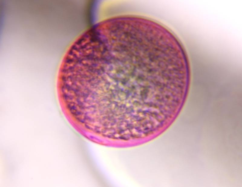 Microscope image of Poaceae — pollen (gallery) — verified by PollyMap