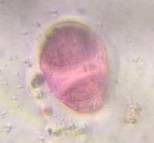 Microscope image of Pine — pollen (gallery) — verified by PollyMap