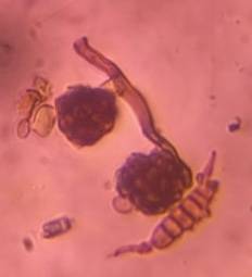Microscope image of Alternaria — mold (gallery) — verified by PollyMap
