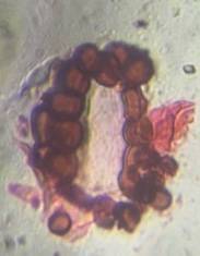 Microscope image of Fern sporangium — dust (reference) — verified by PollyMap