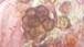 Microscope image of Epicoccum — mold (gallery) — verified by PollyMap