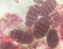 Microscope image of Ulocladium — mold (reference) — verified by PollyMap