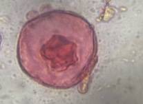 Microscope image of Juniper — pollen (gallery) — verified by PollyMap
