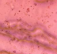 Microscope image of Dust / Particulate Debris — dust (reference) — verified by PollyMap