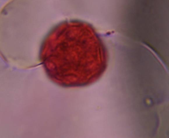 Microscope image of English plantain — pollen (reference) — verified by PollyMap