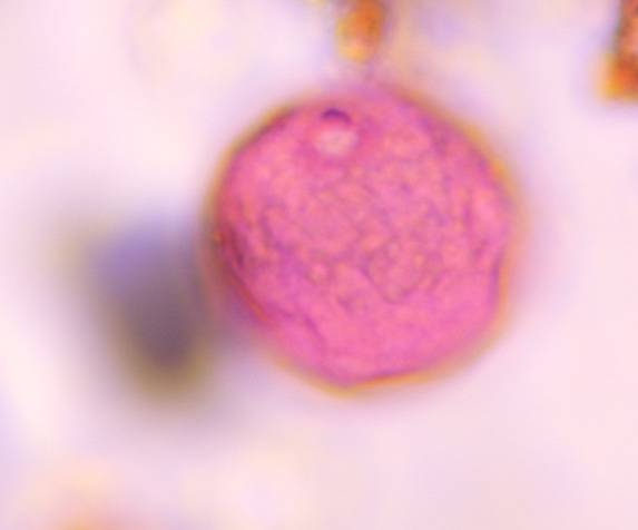 Microscope image of Poaceae — pollen (gallery) — verified by PollyMap