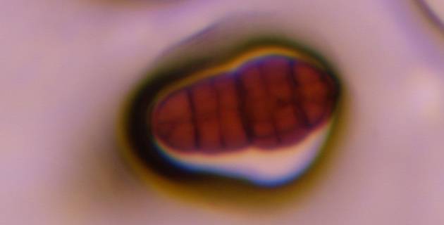 Microscope image of Stemphylium — mold (gallery) — verified by PollyMap