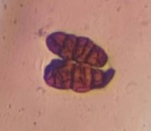 Microscope image of Alternaria — mold (gallery) — verified by PollyMap