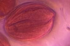 Microscope image of Oak — pollen (gallery) — verified by PollyMap