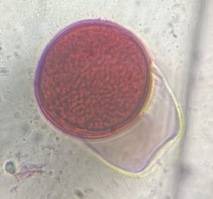 Microscope image of Grass — pollen (gallery) — verified by PollyMap