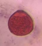 Microscope image of Mulberry — pollen (gallery) — verified by PollyMap