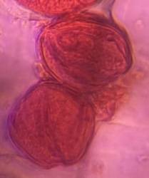 Microscope image of Oak — pollen (gallery) — verified by PollyMap