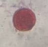 Microscope image of Elm — pollen (reference) — verified by PollyMap