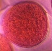 Microscope image of Oak — pollen (gallery) — verified by PollyMap