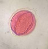 Microscope image of Oak — pollen (gallery) — verified by PollyMap