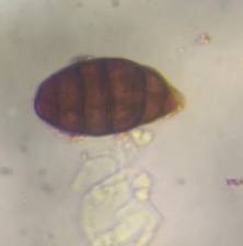 Microscope image of Alternaria — mold (gallery) — verified by PollyMap