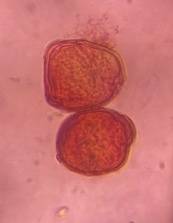 Microscope image of Oak — pollen (gallery) — verified by PollyMap