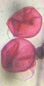 Microscope image of Oak — pollen (gallery) — verified by PollyMap