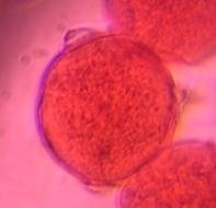 Microscope image of Oak — pollen (gallery) — verified by PollyMap