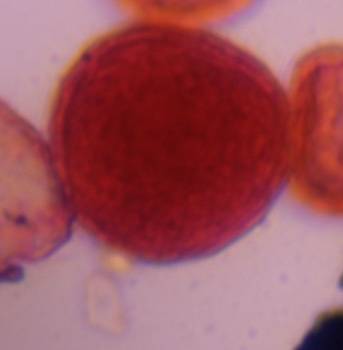 Microscope image of Poaceae — pollen (gallery) — verified by PollyMap