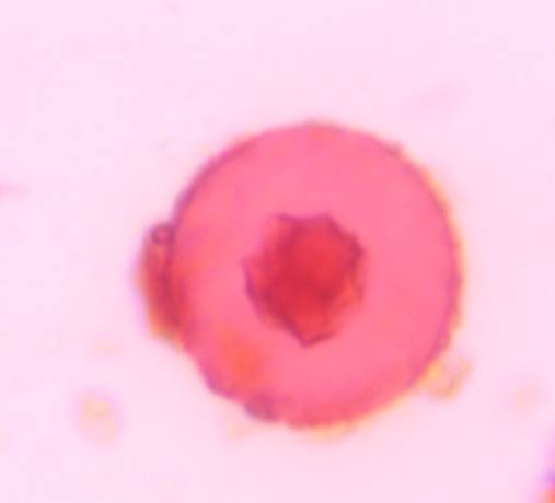 Microscope image of Juniper/Cupressaceae — pollen (reference) — verified by PollyMap