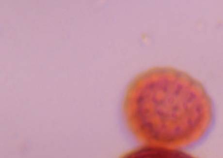 Microscope image of Chenopod — pollen (gallery) — verified by PollyMap