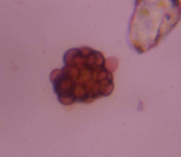 Microscope image of Epicoccum — mold (gallery) — verified by PollyMap